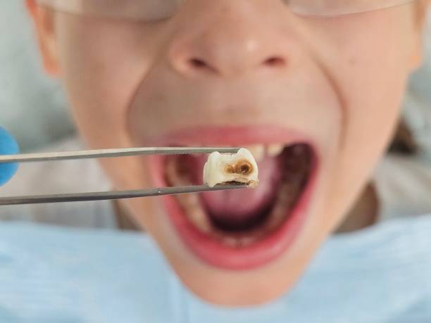 Best Walk-In Emergency Dental Services in Vine Hill, CA